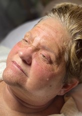During plasma full face 