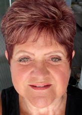 HEALED FACE PLASMA LIFT TREATMENT