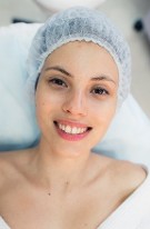 Mesenchymal Stem Cell Face Regeneration is for everyone!