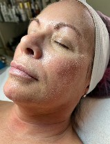 Before Mesenchymal Stem Cell Firming