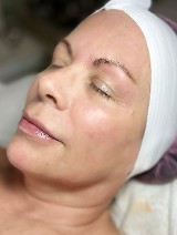 After Mesenchymal Stem Cell Firming