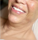  Before Throat Mesenchymal Stem Cell Firming